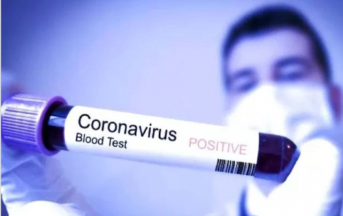 Dinkes Pastikan Tidak Ada Warga Siak Terjangkit Virus Corona
