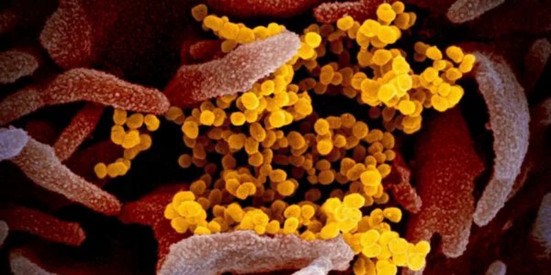 Setelah Covid-19, Virus Misterius HMPV Menyebar di Tiongkok