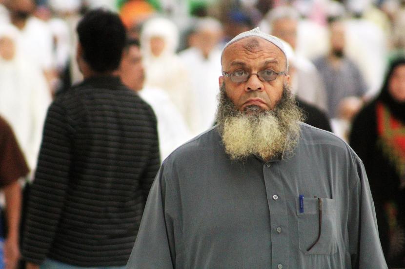 Memahami Hakikat Tanda Bekas Sujud