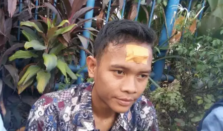 Seorang Aktivis Mahasiswa UIN Suska Terluka Saat Dorong-dorongan Pagar DPRD Riau
